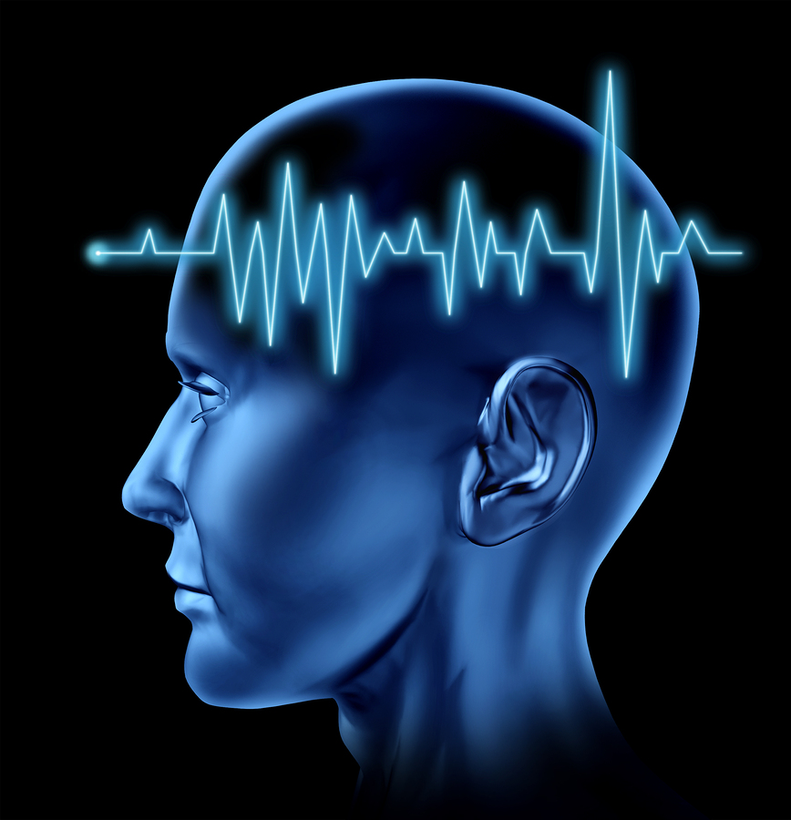 Wissenswertes Hirninfarkt